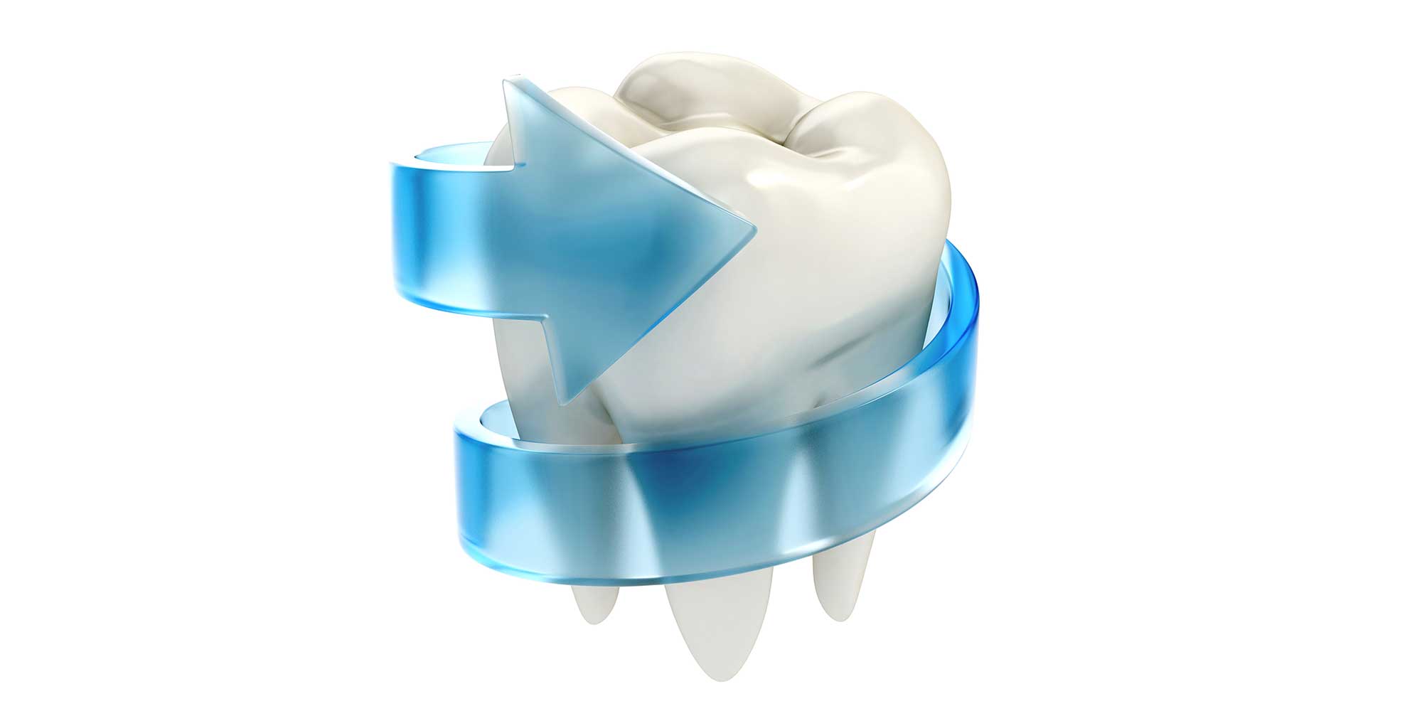 Dental Sealants Tooth Sealants Available in Middleburg at Myers