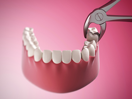 This image features a close-up of a dental implant being inserted into a mouth with visible teeth, using a pair of surgical scissors to guide the placement.